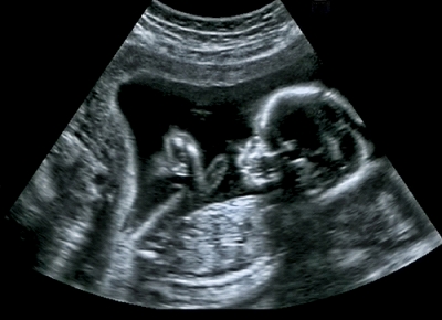 妊娠時のエコー検査の仕組みが知りたい Babydot ベイビードット