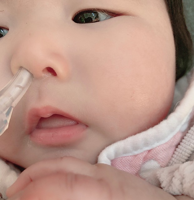 赤ちゃんの鼻水取りどうしてる お子さんがいる家庭には一家に一台 Babydot ベイビードット 赤ちゃんの鼻水取りどうしてる お子さんがいる家庭には一家に一台 Babydot ベイビードット