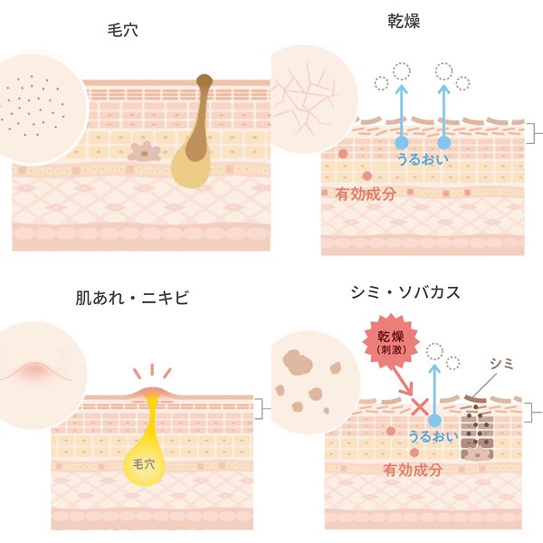 4大肌悩みを解決